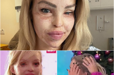 [Life Changed Forever] Inside Katie Piper’s health issues following @CID ATT@CK – more than 250 OPERATIONS; secret SEP$IS battle; hair TRANSPL@NT; eye REM0VAL.