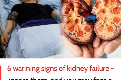 Your kidneys may be failing, and you don’t even know it! ⚠️ Recognize these warning signs before it’s too late! 🚨